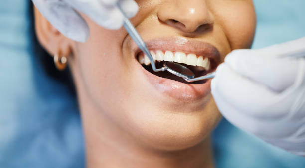 Best Emergency Dentist for Lost Fillings or Crowns in Harper, TX